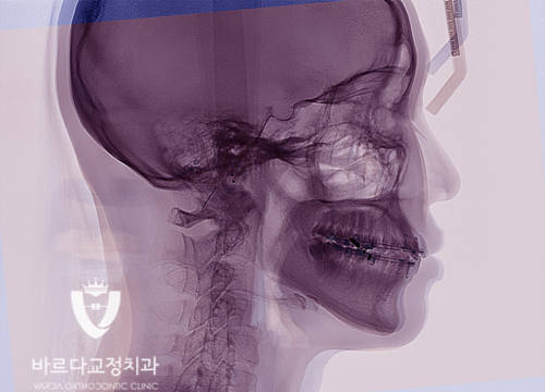 fe9e5f635730004caac53f5ad6dd302a_1551236564_2974.jpg