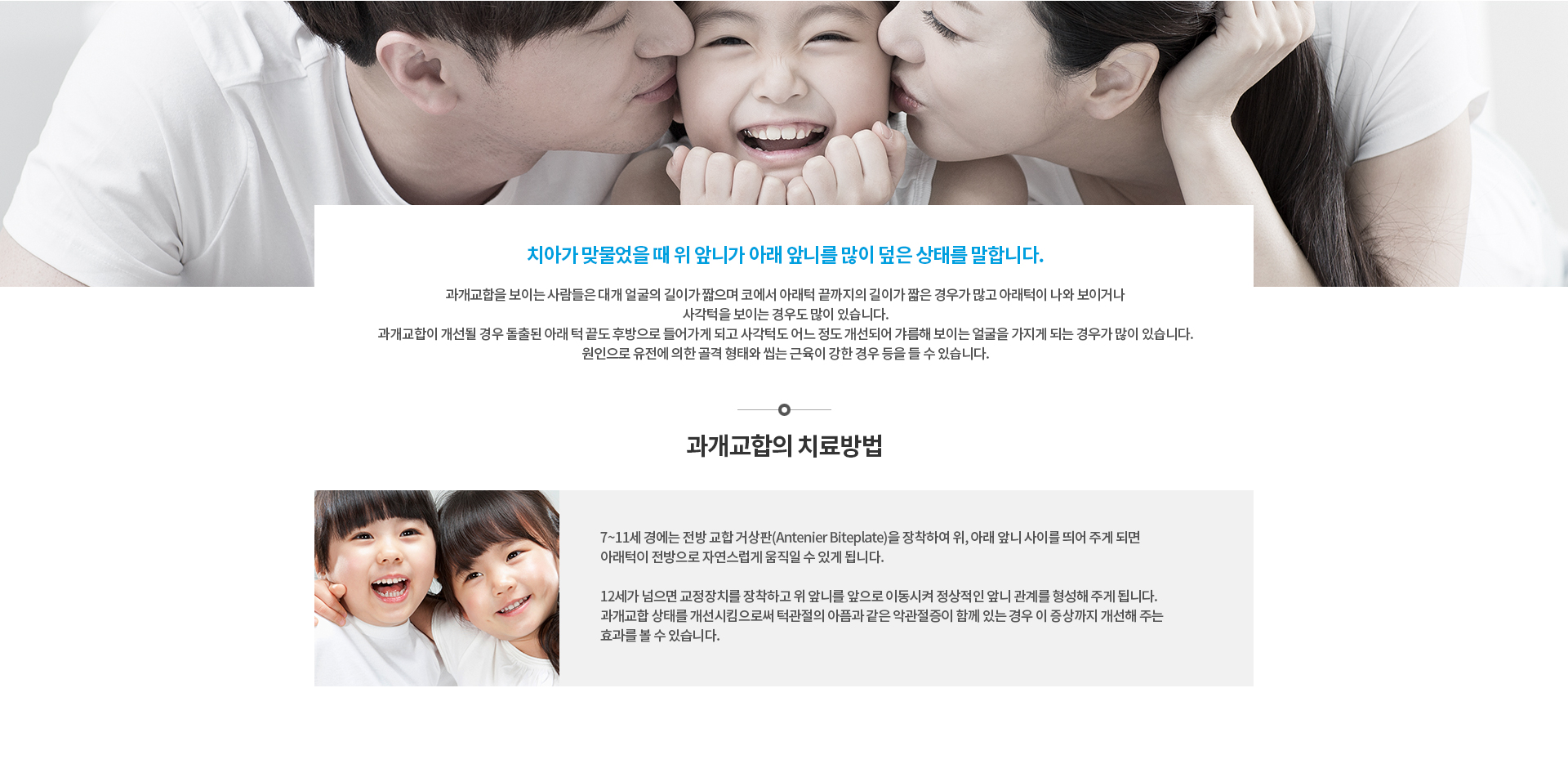 과개교합 진료 안내 사진